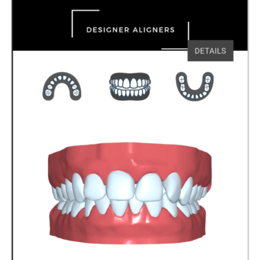 Treatment 3D Simulation